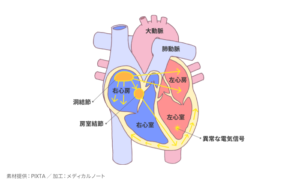 不整脈とはのイメージ